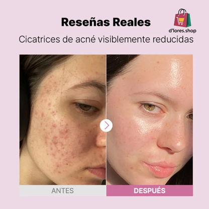 ANUA 10+ Serum Niacinamida